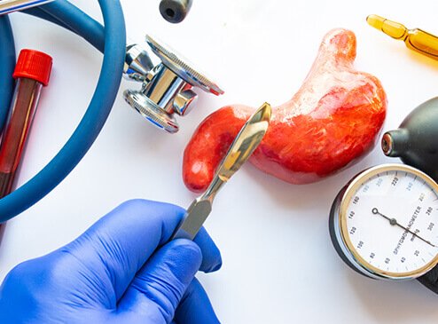 CHIRURGIE BARIATRIQUE