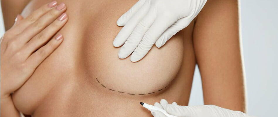 Lipofilling