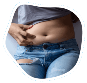 Abdominoplasty (Tummy Tuck) - Clinique La Rose