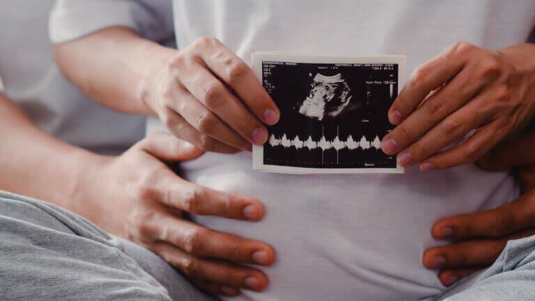 ultrasound photo baby in belly