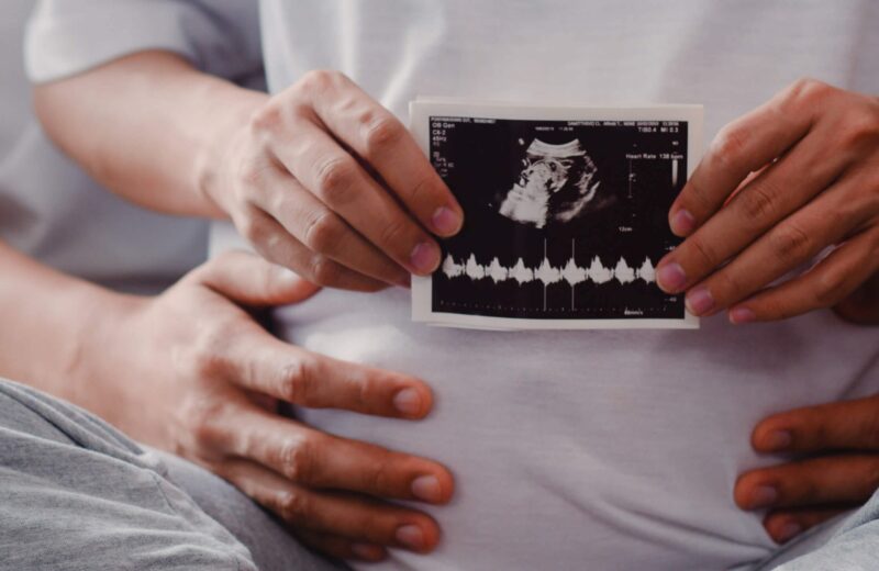ultrasound photo baby in belly