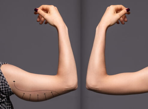 silhouette Lifting des bras 1 8