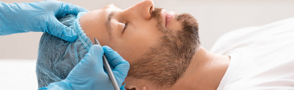 chirurgie visage