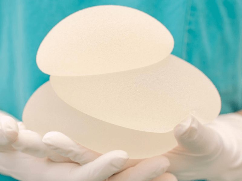 Changement de prothèse mammaire : implants mammaires